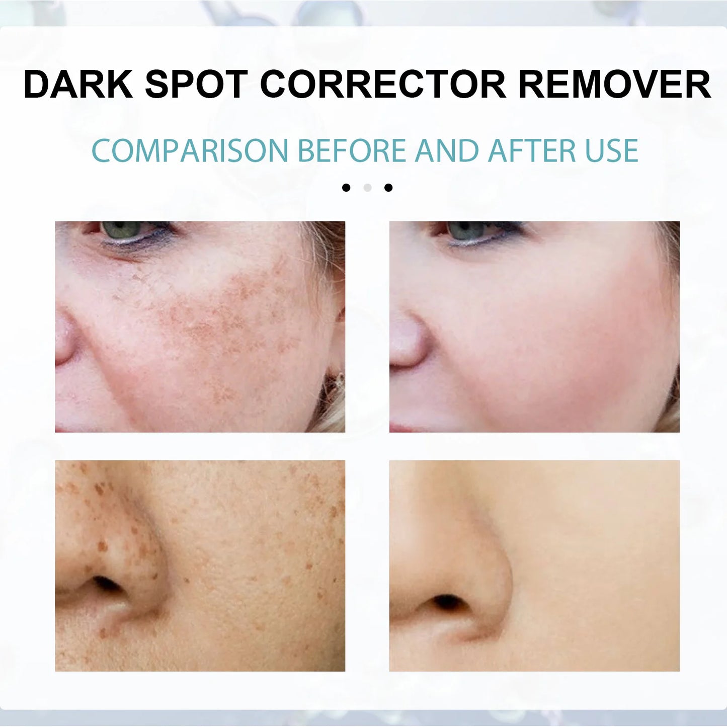 Retinol Whitening And Spot Removing Cream Softens Fine Lines & Wrinkles Repairs Skin Barriers Moisturizing And Brightening Face
