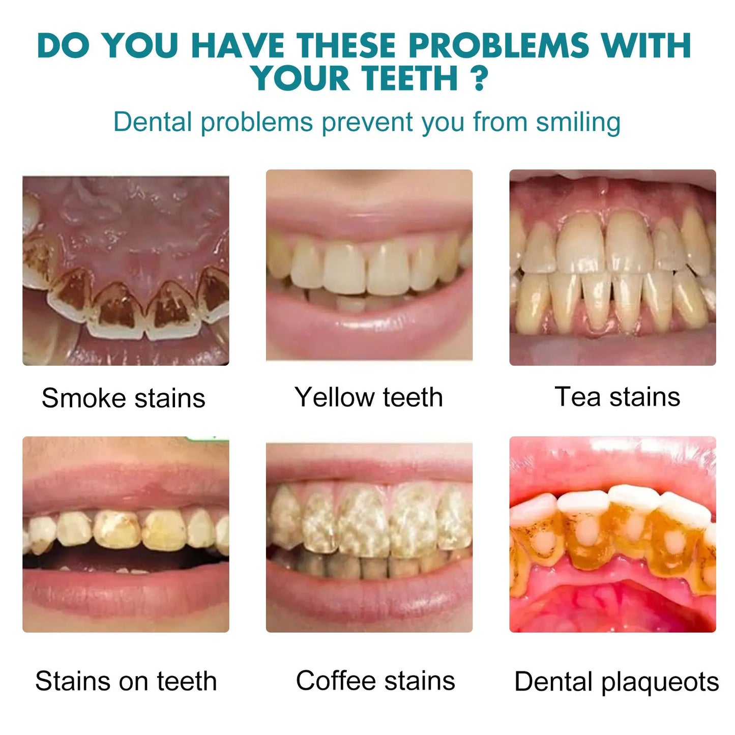 Teeth White Paint Anti Pigmentation Remove Smoke Stains Bad Breath Clean Tartar Oral Care Paint whitening whitening tooth