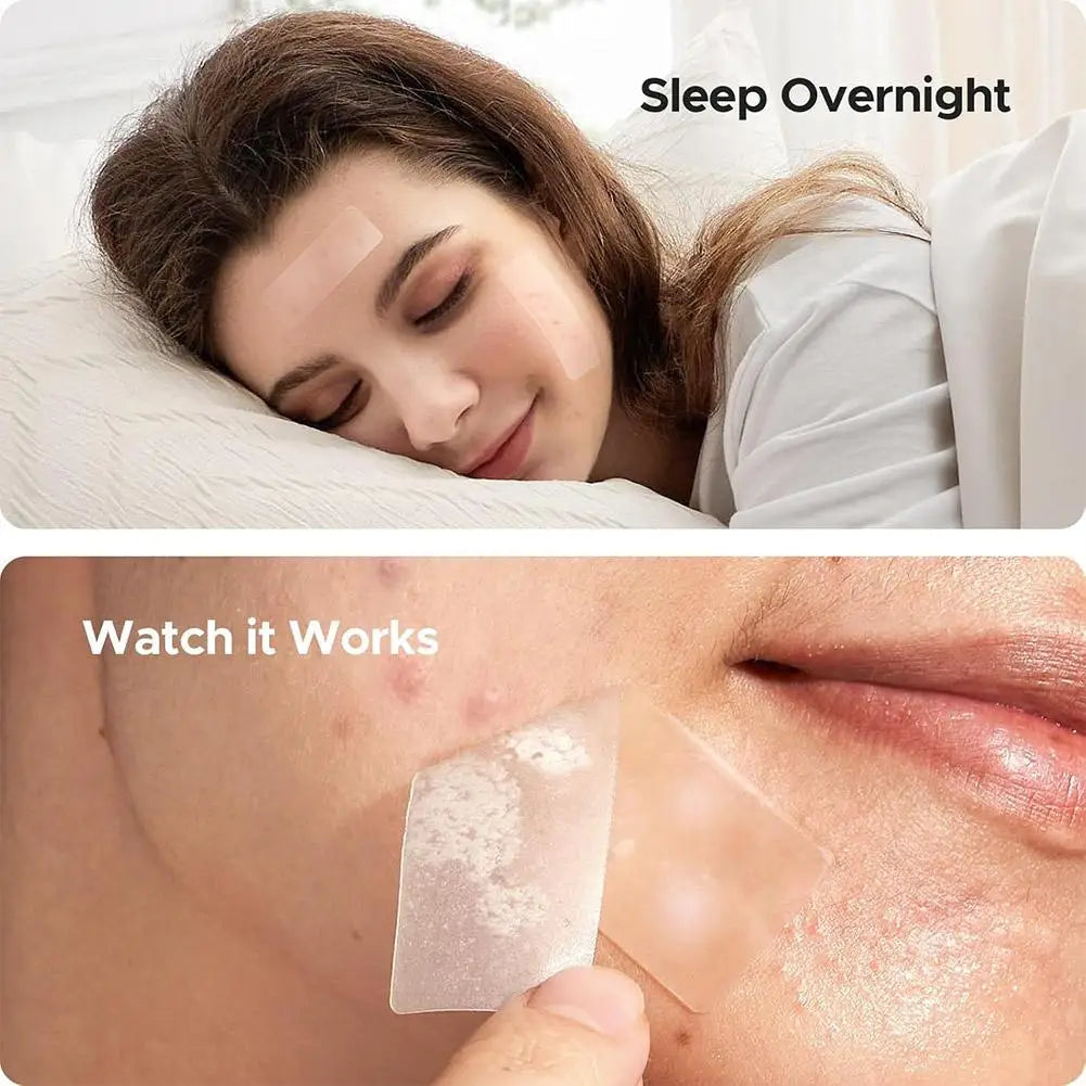 Large capacity Pimple Patches for Acne & Blemishes Various Shapes Covering Acne and Spot Patches for Face Skin Care Tool