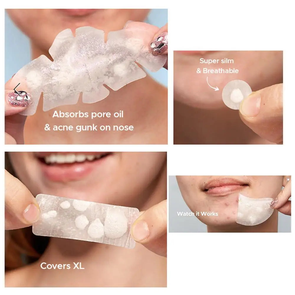 Large capacity Pimple Patches for Acne & Blemishes Various Shapes Covering Acne and Spot Patches for Face Skin Care Tool